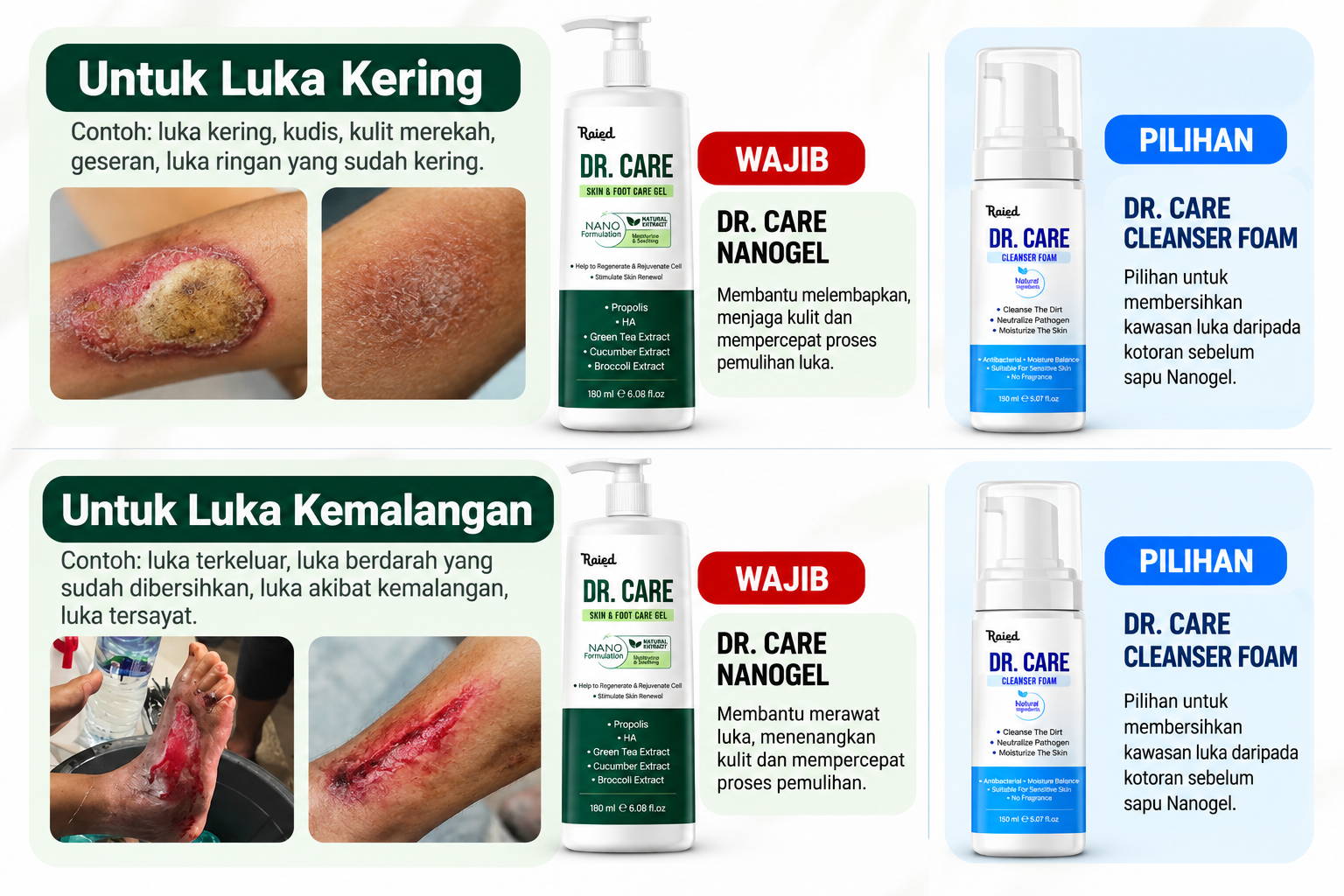 Panduan Penjagaan Luka Kering dan Kemalangan