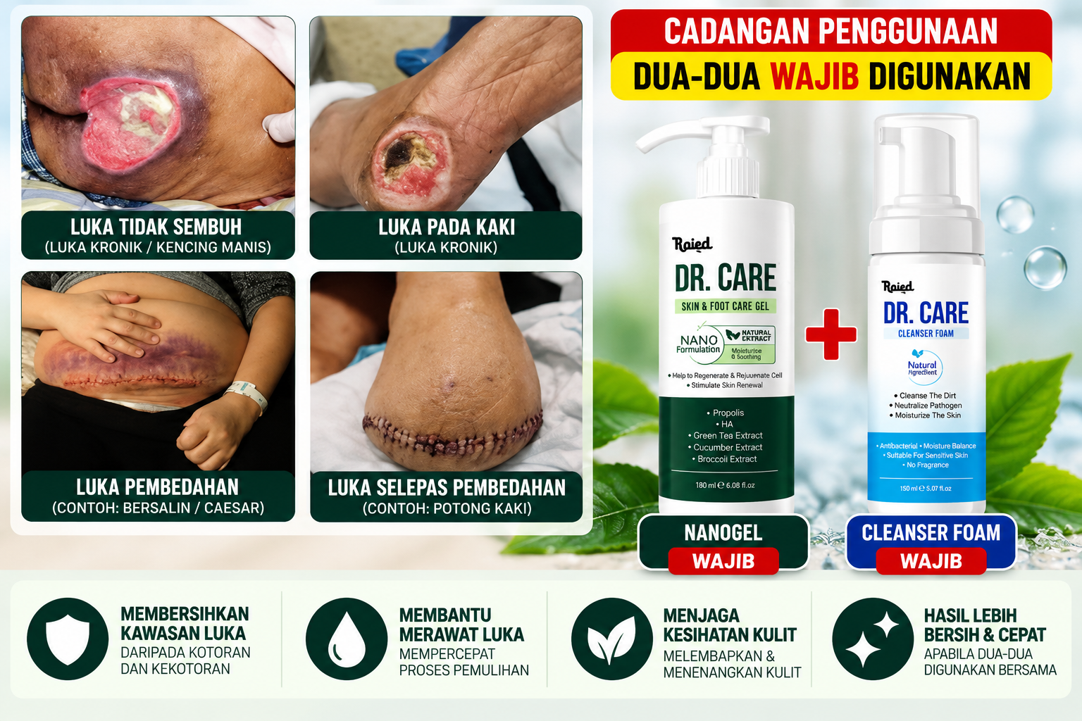 Panduan Rawatan Luka dengan Nanogel Cleanser
